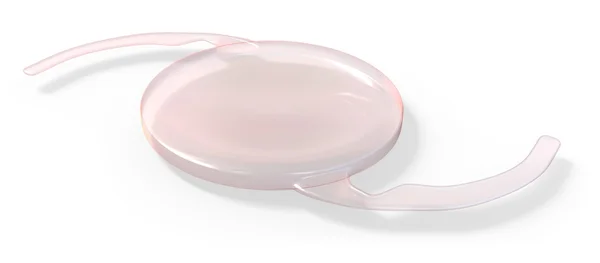 Göz içi lens implant