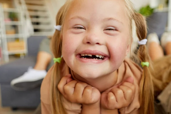 Detailní Záběr Portrét Blondýny Syndromem Šťastně Usmívá Při Pohledu Kameru — Stock fotografie