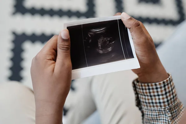 Boy Holding X Ray of Baby — Stock fotografie