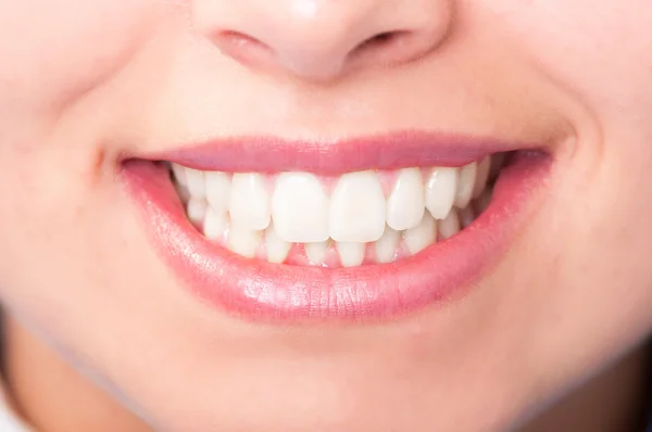 Close-up de mulher boca com dentes brancos perfeitos — Fotografia de Stock