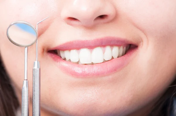 Close up of woman perfect smile with dental equipment — Stock Photo, Image