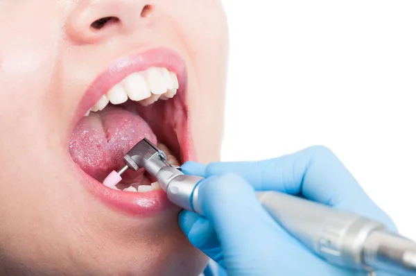 Primo piano dello strumento dentale utilizzato dal dentista per lucidare i denti — Foto Stock