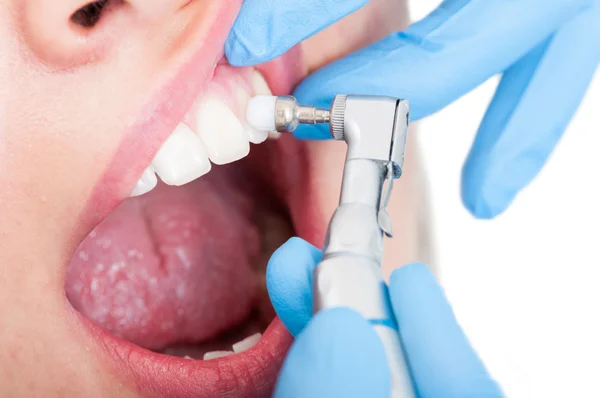 Close-up of young woman patient with female dentist — Stock Photo, Image