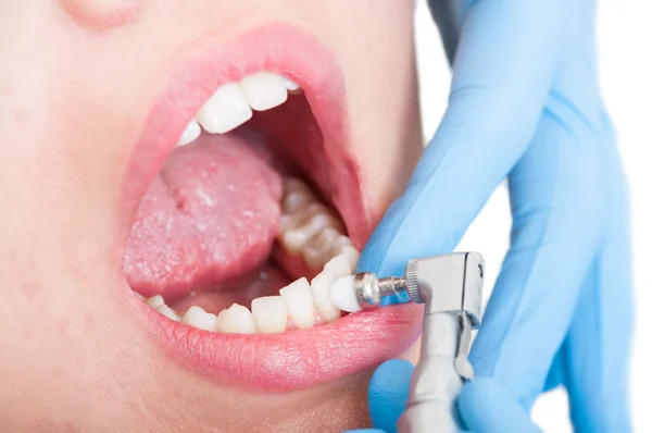 Closeup of female patient having dental brush — Stock Photo, Image