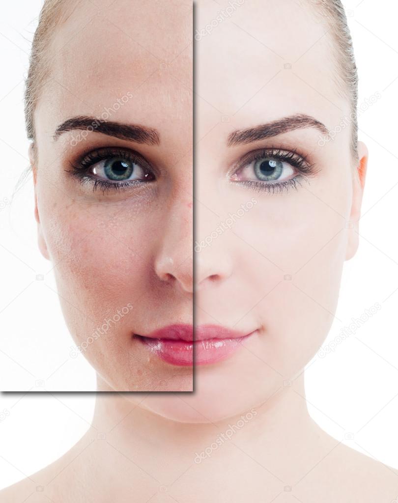 Portrait of attractive woman with problem and clean skin 