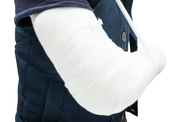 Close-up of patient with  fractured forearm after accident — Stock Photo, Image