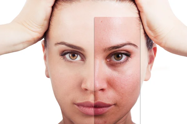 Retrato de mulher sem falhas antes e depois da correção facial — Fotografia de Stock