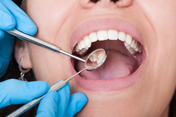 Ferramentas odontológicas e boca aberta com dentes bonitos — Fotografia de Stock