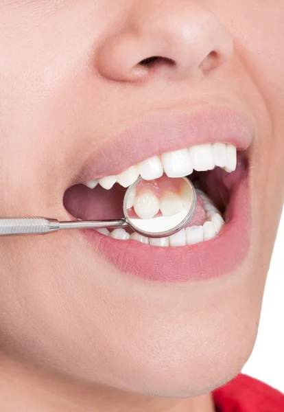 Specchio dentista che riflette i denti interni — Foto Stock