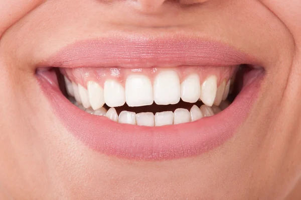 Primo piano di denti femminili perfetti sorridenti — Foto Stock