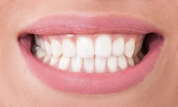 Closeup met perfecte vrouwelijke tanden Stockafbeelding