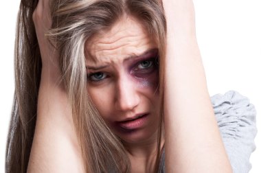 Acı acı, yaralı ve üzgün kadın