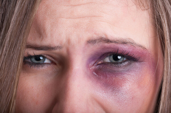 Sad eyes of a domestic violence victim