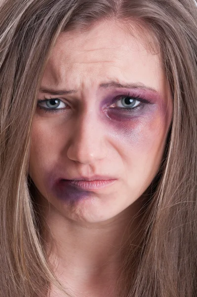 Sad face almost crying of an injured woman Stock Picture