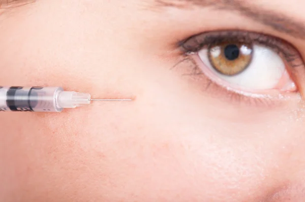 Botox for eyes wrinkle — Stok fotoğraf