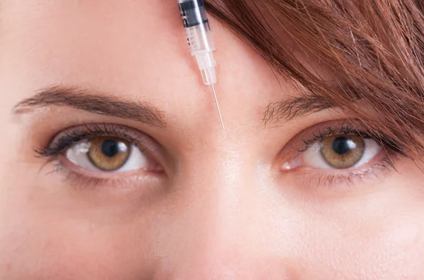 Botox seringa agulha entre os olhos na testa — Fotografia de Stock
