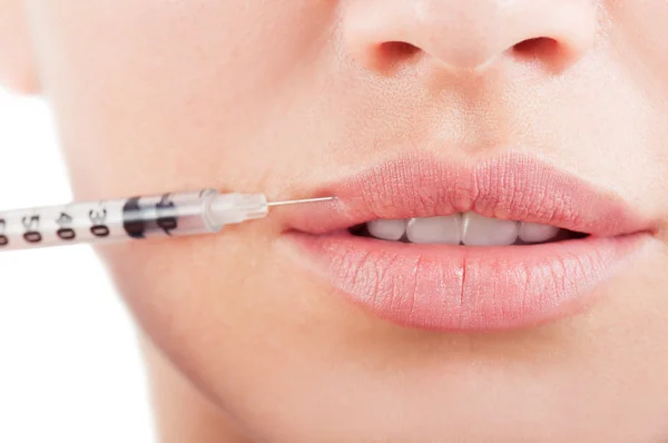 Hermosa boca y labios con botox — Foto de Stock