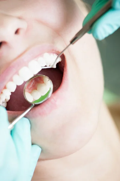 Riflessione dei denti sullo specchio dentista — Foto Stock