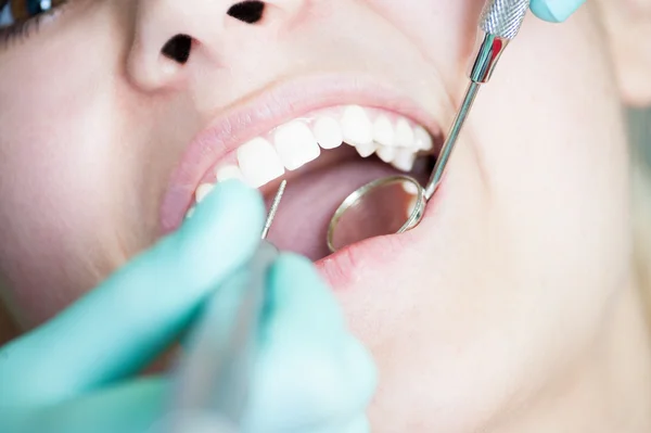 Procedimento de perfuração dentária em bela dentadura branca — Fotografia de Stock