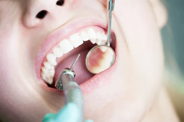 Procedimento de perfuração dentária em dentes bonitos — Fotografia de Stock