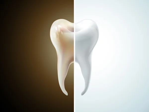 Vergelijking van tand — Stockvector