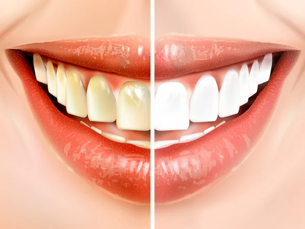 Comparação dos dentes —  Vetores de Stock