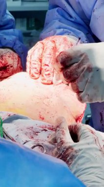 Kharkiv, Ukrayna 12.12.24 Deneyimli mavi ceketli cerrahlar hastanedeki askeri hastaları ameliyat ediyorlar.