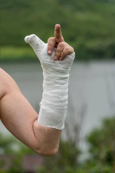 Ένα Αρσενικό Χέρι Ένα Γύψο Σημάδι Από Μεσαίο Δάχτυλο Προς — Φωτογραφία Αρχείου