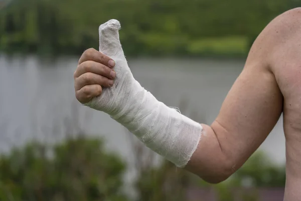 Man Hand Ett Gips Gjuten Med Upphöjd Tumme Upp Bakgrunden — Stockfoto