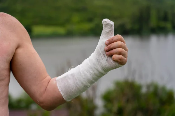 Mano Masculina Yeso Con Pulgar Levantado Fondo Naturaleza Cerca —  Fotos de Stock