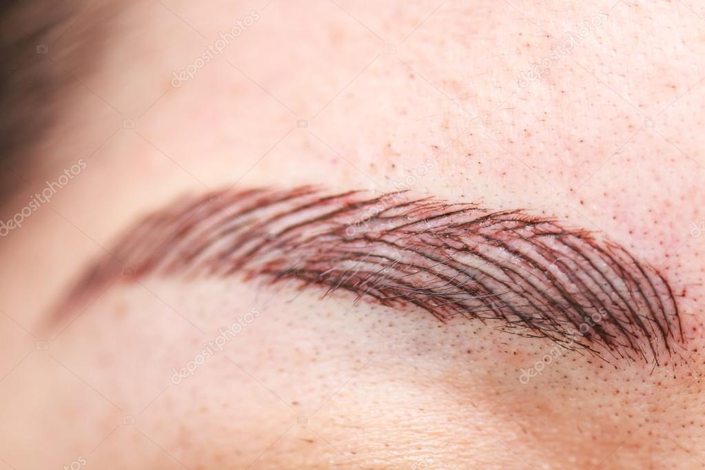 Eyebrow Tattoo Removal  Effective Ways to Remove an Unwanted Brow Tattoo