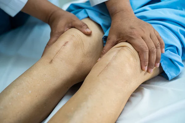 Asiatische Seniorin Oder Ältere Patientin Zeigt Ihre Narben Chirurgischer Gesamt — Stockfoto