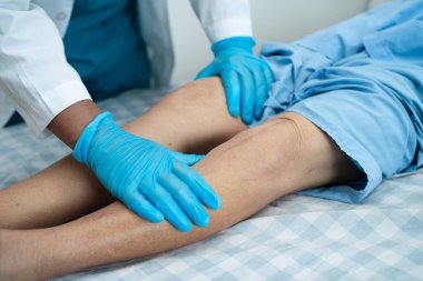 Asyalı yaşlı ya da yaşlı kadın hasta yaralarını gösteriyor. Diz eklemi ameliyatıyla değiştirilmiş. Hemşirelik hastanesi koğuşunda yatağında eklem iltihabı var..