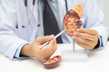 Böbrek hastalığı, Kronik Böbrek Hastalığı, Doktor, hastanede tedavi ve eğitim için insan modeli tutuyor..