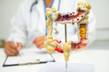Bağırsak, apandis ve sindirim sistemi, hastanede teşhis ve tedavi için anatomi modelini tutan doktor..