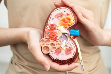 Kronik böbrek hastalığı, idrar sistemi, üroloji, tahmini küresel filtreleme oranı eGFR olan Asyalı kadın..