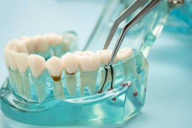 Diş hekimliği için dişçi aracı olan diş modeli.