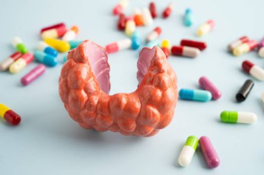 İlaç tedavisi gören tiroid modeli, Hipertiroidizm, Aşırı Aktif veya Lenfoma.