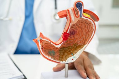 Mide hastalığı, hastanede teşhis ve tedavi için anatomi modeli tutan bir doktor..
