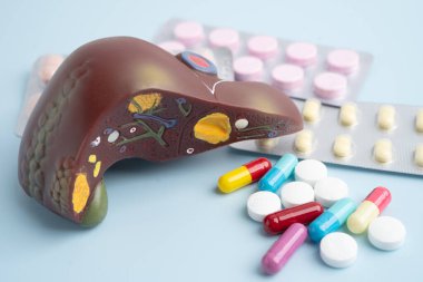 Hap tedavisi gören karaciğer modeli, siroz, karaciğer kanseri, yağlı karaciğer..