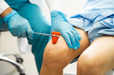 Ortopedi kliniğinde kıdemli bir hastanın diz ve bacağını muayene eden Asyalı doktor fizyoterapisti..