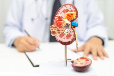 Böbrek hastalığı, Kronik Böbrek Hastalığı, Doktor, hastanede tedavi ve eğitim için insan modeli tutuyor..