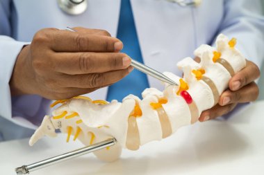 Ortopedi bölümünde tedavi için omurga iskeleti ve sinir modeline sahip bir doktor..