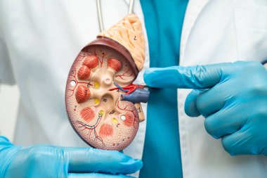 Böbrek hastalığı, Kronik Böbrek Hastalığı, Doktor, hastanede tedavi ve eğitim için insan modeli tutuyor..