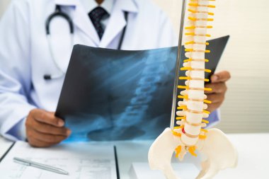 Doktor omurga röntgen filmini inceliyor..