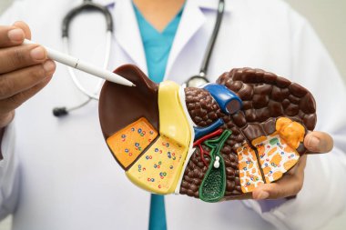 Siroz, karaciğer kanseri, yağlı karaciğer, karaciğer anatomisi olan Asyalı kadın..