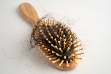 Saç dökülmesi tarakla birlikte düştü. Ciddi sağlık, güzellik ve kozmetik sorunları..