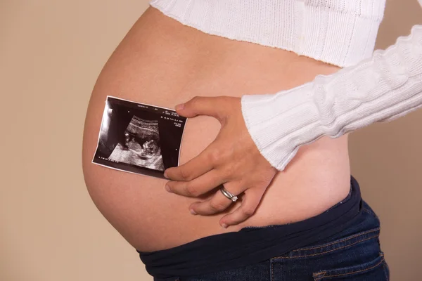 Pregnant woman holding an ultrasound photo on her exposed belly — Stock Photo, Image