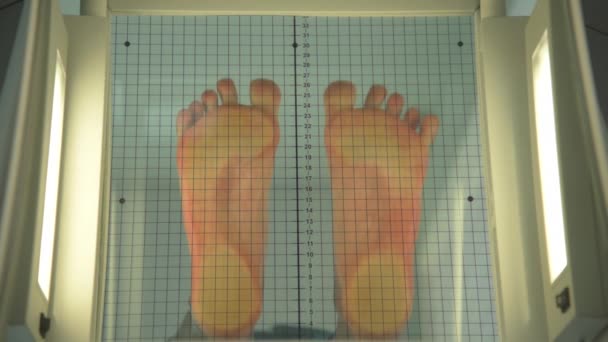 El paciente se coloca sobre un aparato especial para determinar los pies planos. el cirujano ortopédico evalúa la distribución de la carga de los pies. Determinación del tipo de pie plano. Determinación de la — Vídeo de stock