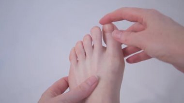 Baş parmağın deformasyonu. Düz taban. Kinesio bantlama kullanılarak parmağın konumu düzeltiliyor